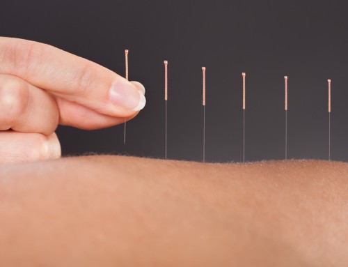 Acupuntura